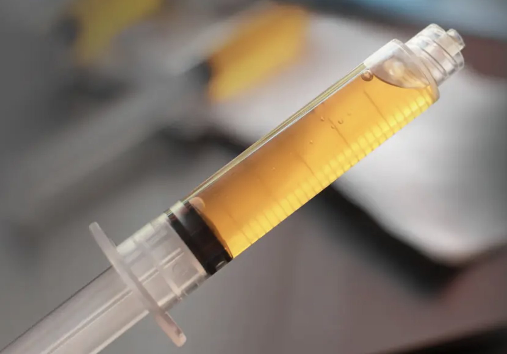 Syringe of platelet-rich plasma prepared from the patient's own blood