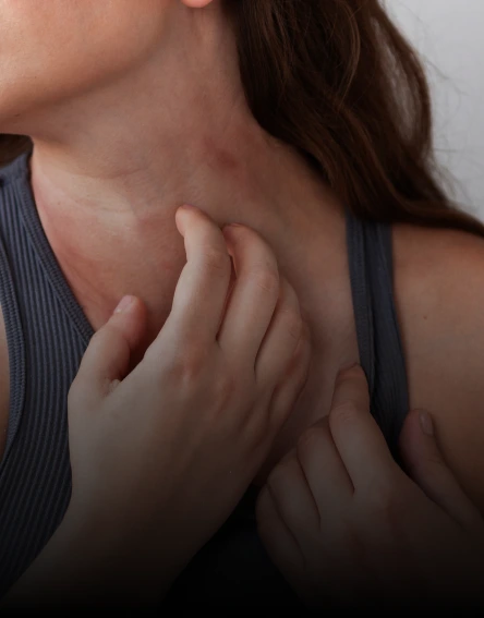 Conditions treated with microneedling