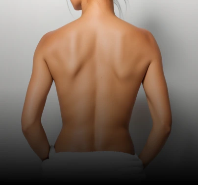 back - Area for laser hair removal