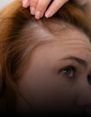 Hair loss Banner