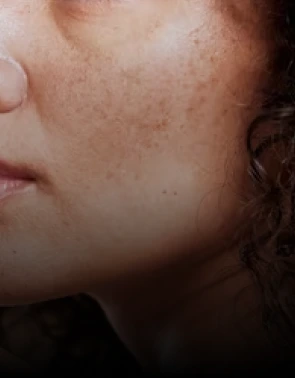 Uneven skin texture Banner