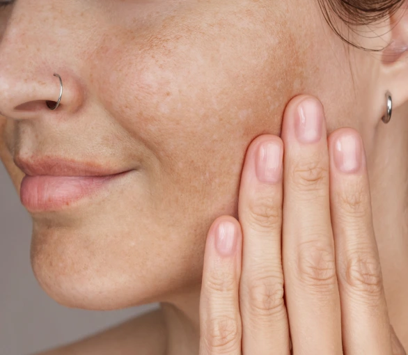 Skin Conditions Portland, OR: Brown Spots Banner