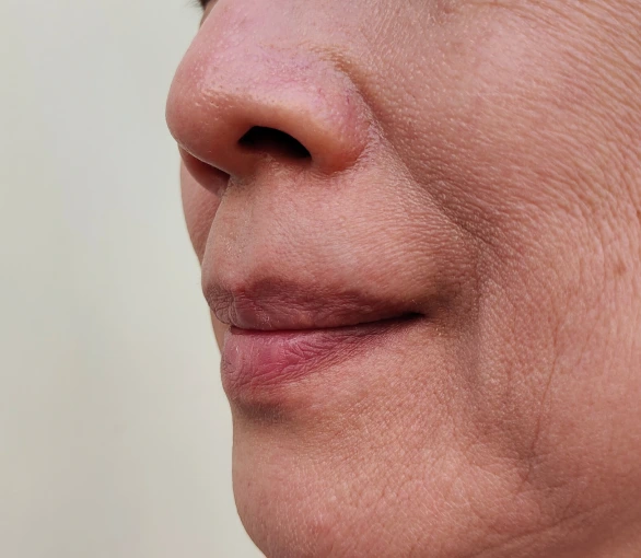Skin Conditions in Portland OR: Loose Skin Banner