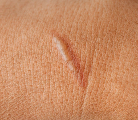 Portland, OR Skin Conditions: Scars Banner