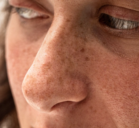 Portland, OR Skin Conditions: Sun Damage Banner